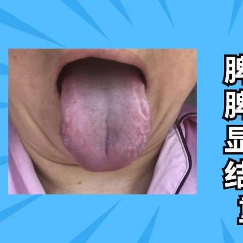 抖音月付如何简单快速套出来呢？